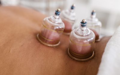 Cupping Therapy: An Ancient Massage Therapy